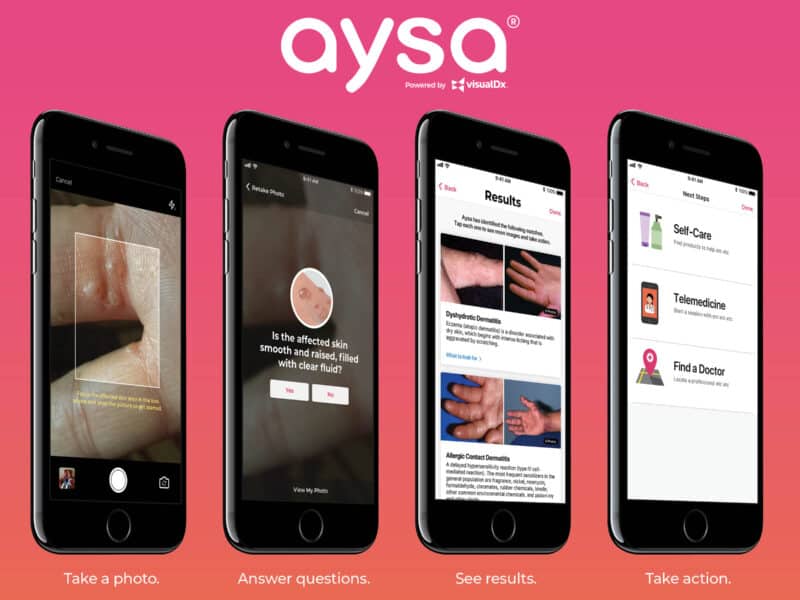 Personalized Search for Your Skin Problems: Take a Picture, Ask Aysa.