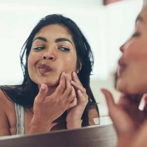Dealing with Acne: A Beginner’s Guide